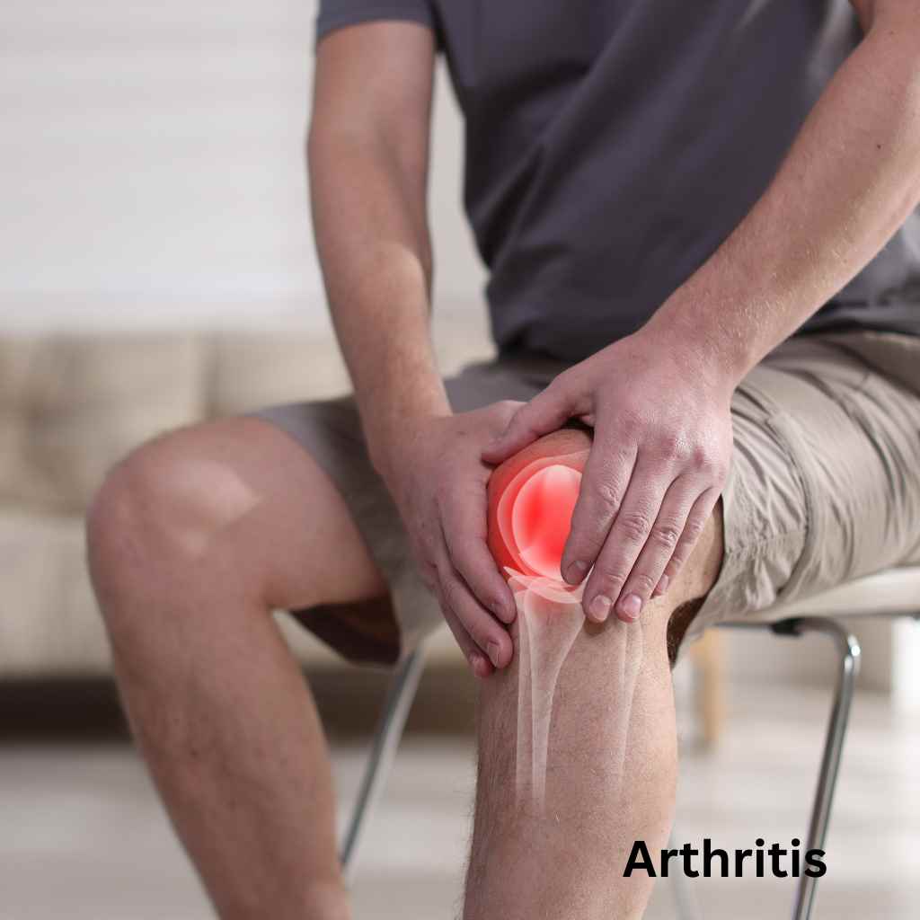 Arthritis: Causes, Effects, and the Core Varieties